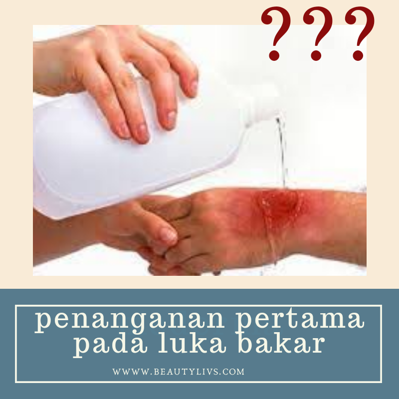 Detail Gambar Luka Bakar Derajat 2 Nomer 57