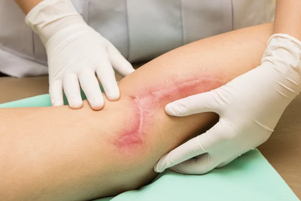 Detail Gambar Luka Di Lutut Wanita Nomer 28