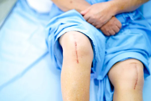 Detail Gambar Luka Di Lutut Wanita Nomer 55