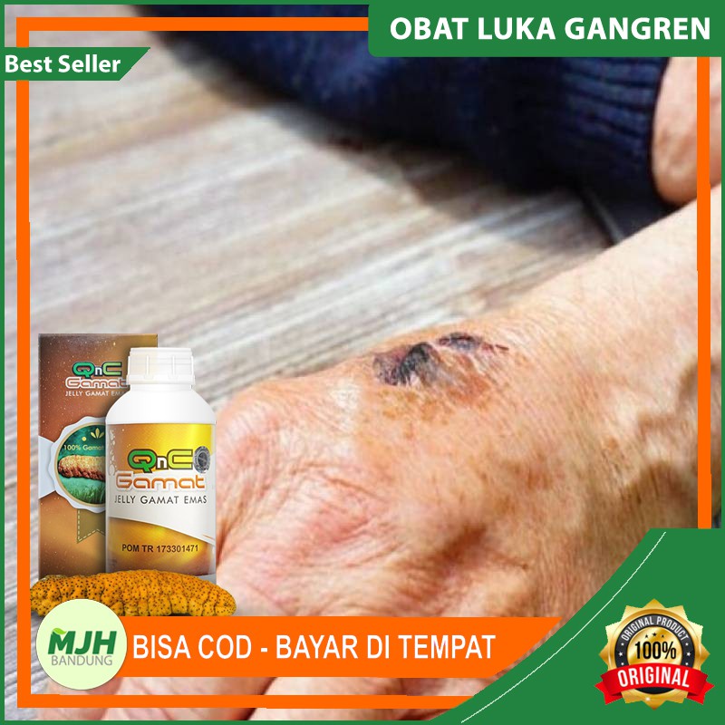 Detail Gambar Luka Gangren Nomer 51