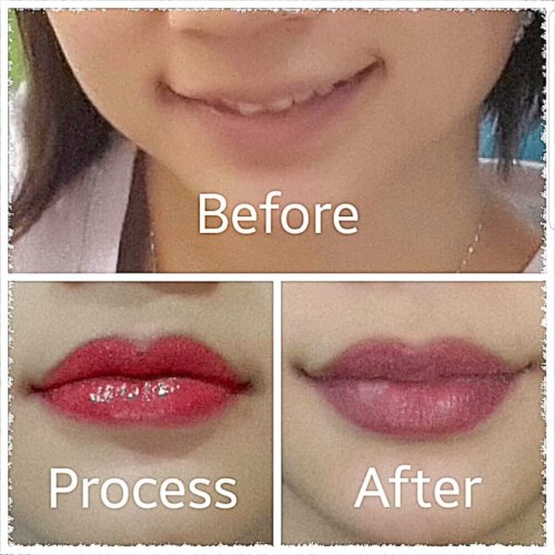 Detail Contoh Sulam Bibir Nomer 7