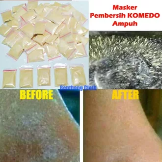 Detail Gambar Masker Gelatin Nomer 15