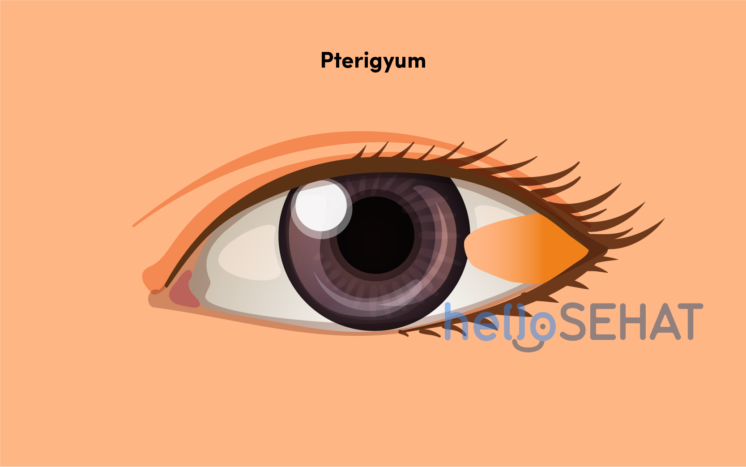 Detail Gambar Mata Bagian Dalam Nomer 44