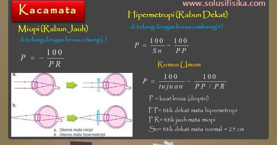 Detail Gambar Mata Hipermetropi Nomer 46