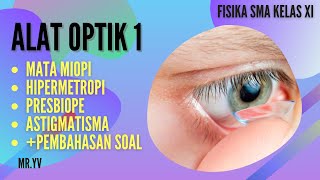 Detail Gambar Mata Hipermetropi Nomer 49