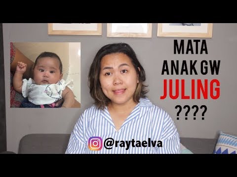 Detail Gambar Mata Juling Pada Bayi Nomer 26