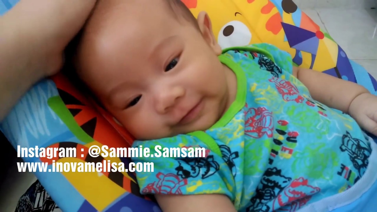 Detail Gambar Mata Juling Pada Bayi Nomer 44