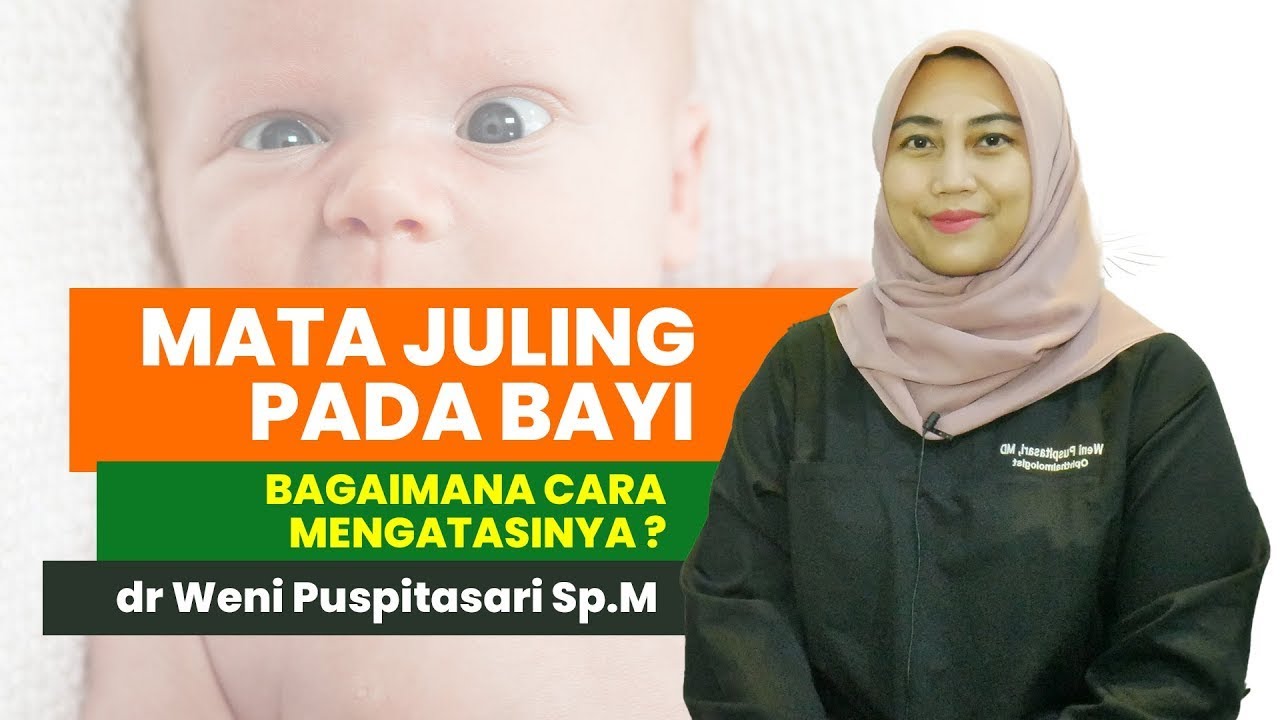 Detail Gambar Mata Juling Pada Bayi Nomer 45