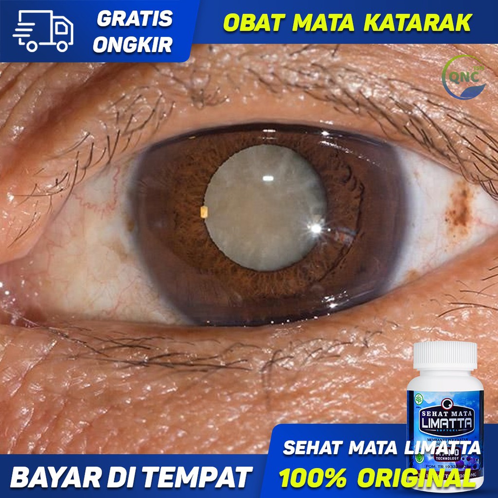 Detail Gambar Mata Katarak Nomer 42