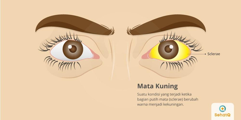 Detail Gambar Mata Kuning Nomer 4