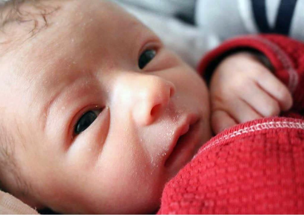 Detail Gambar Mata Normal Pada Bayi Nomer 14