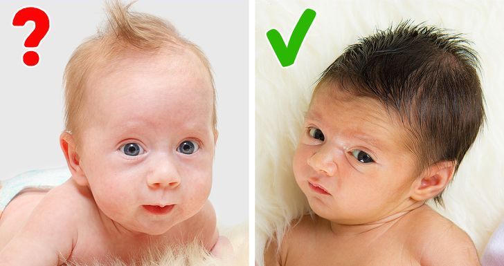 Detail Gambar Mata Normal Pada Bayi Nomer 20