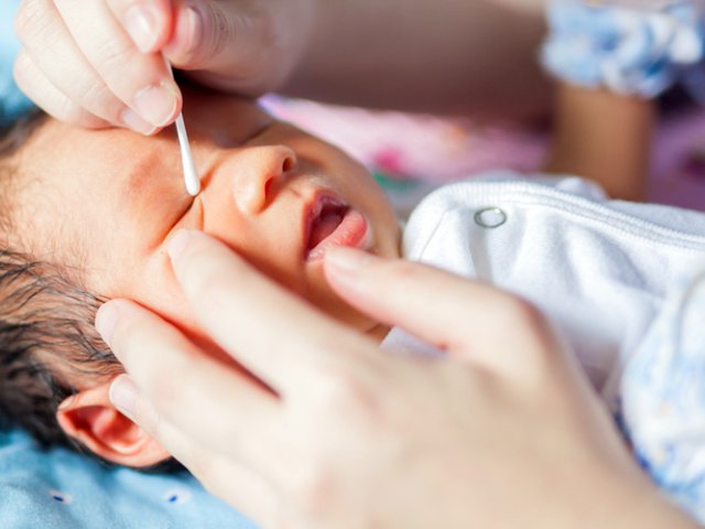 Detail Gambar Mata Normal Pada Bayi Nomer 38