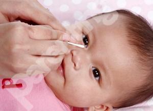 Detail Gambar Mata Normal Pada Bayi Nomer 45