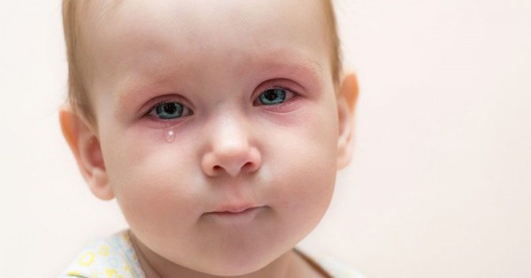 Detail Gambar Mata Normal Pada Bayi Nomer 48