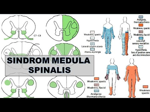 Detail Gambar Medula Spinalis Nomer 38