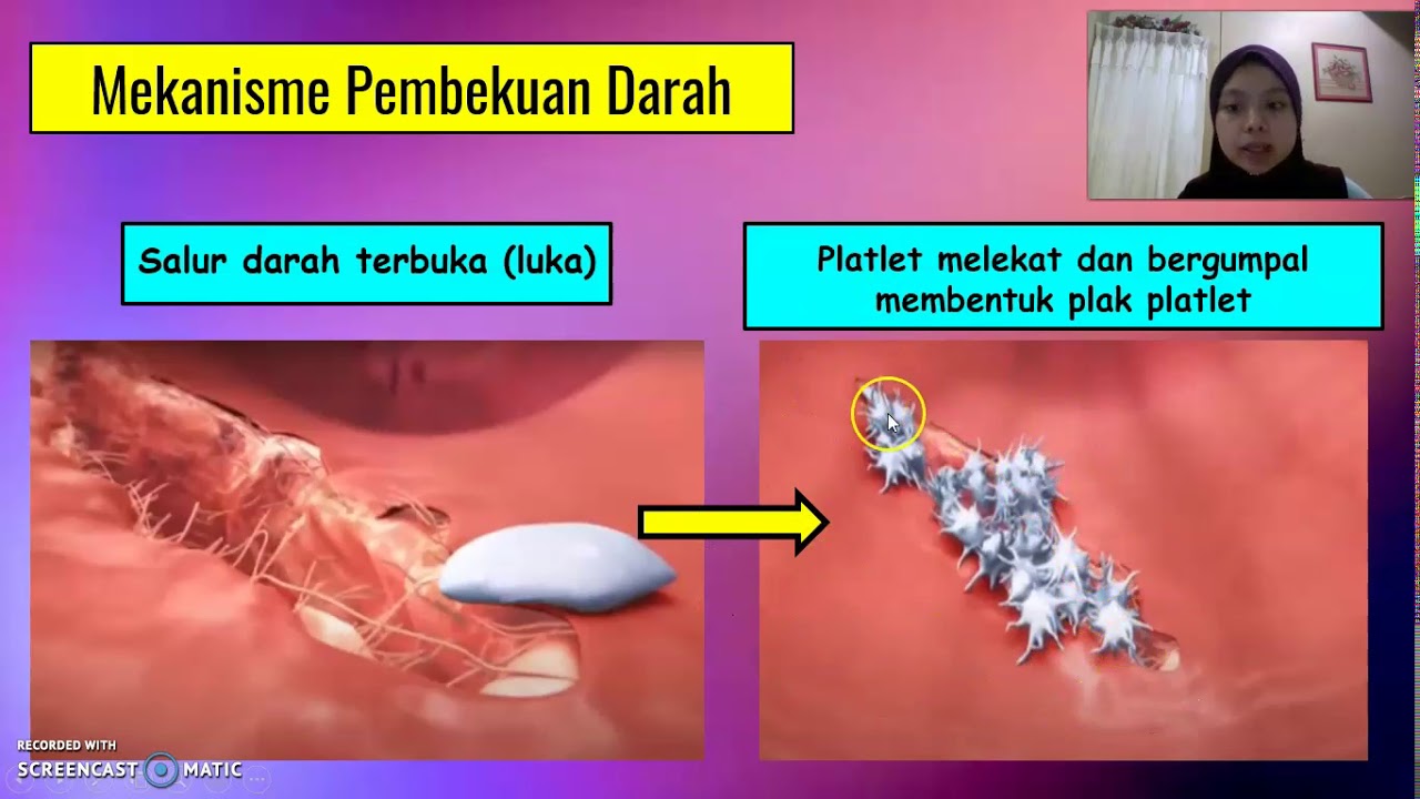 Detail Gambar Mekanisme Pembekuan Darah Nomer 36