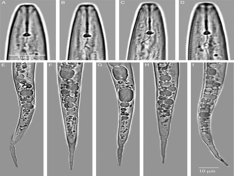 Detail Gambar Meloidogyne Sp Nomer 30