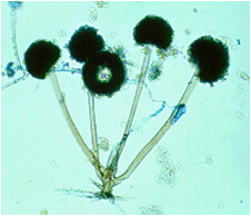 Detail Gambar Miikroorganisme Rhyzopus Nomer 2