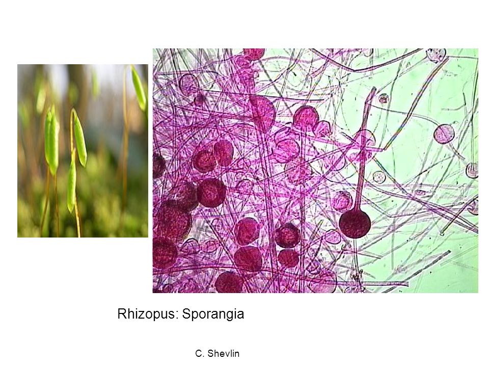 Detail Gambar Miikroorganisme Rhyzopus Nomer 44