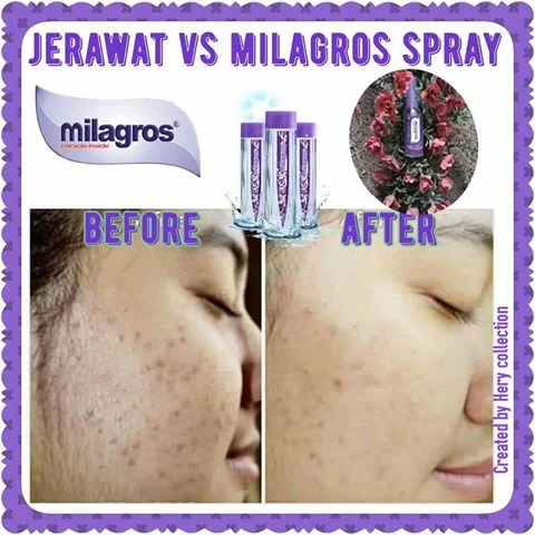 Detail Gambar Milagros Gambar Milagros Spray Nomer 27