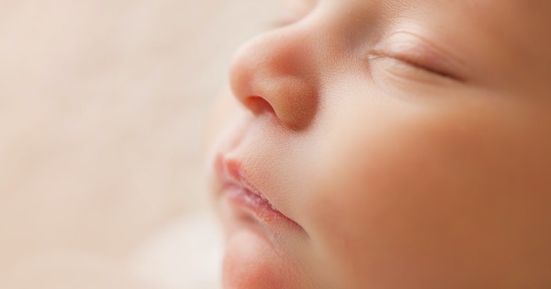 Detail Gambar Milia Pada Bayi Nomer 14