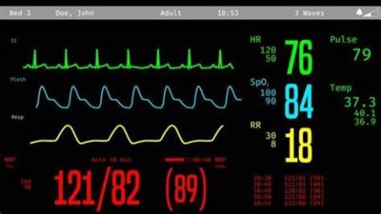 Gambar Monitor Detak Jantung - KibrisPDR