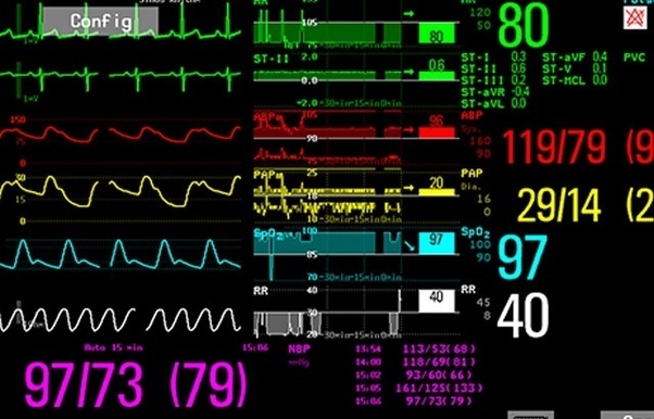 Detail Gambar Monitor Detak Jantung Nomer 6