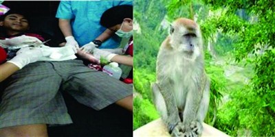 Detail Gambar Monyet Rabies Nomer 7