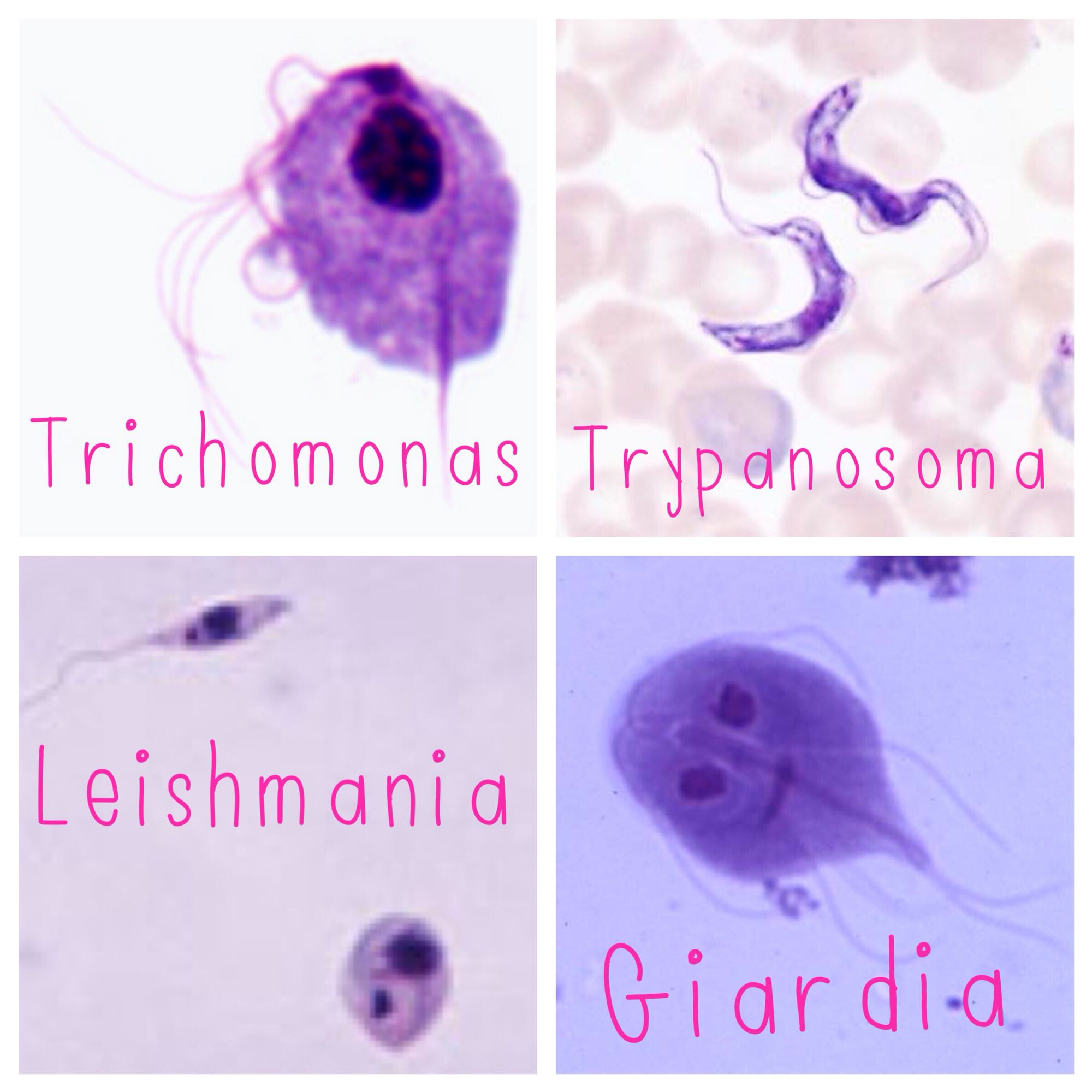 Detail Gambar Morfologi Tricmonas Vaginlis Nomer 5