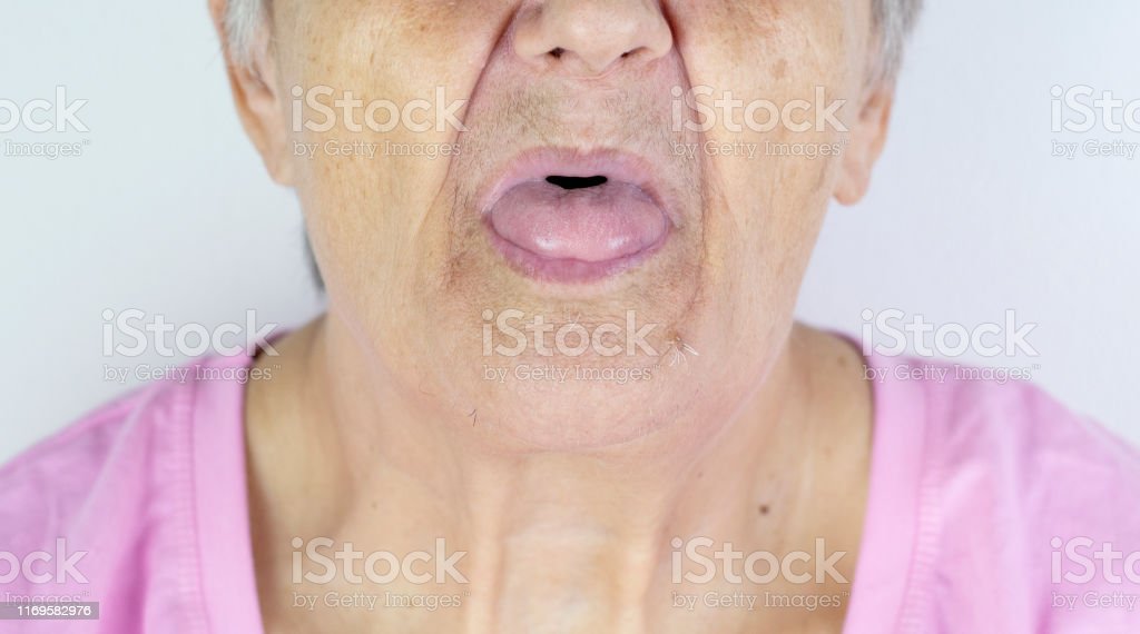 Detail Gambar Nenek Ompong Nomer 30