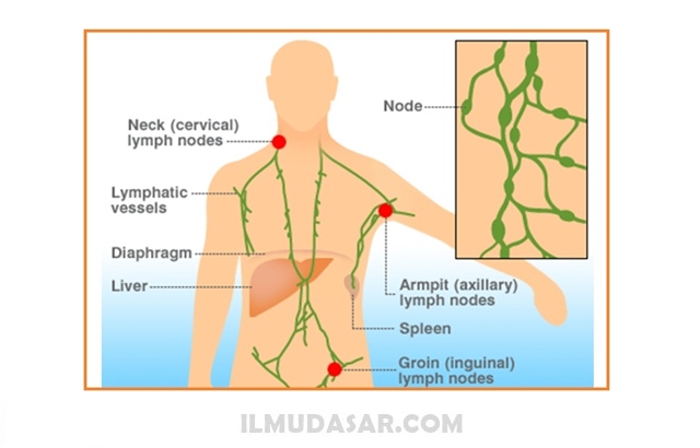 Detail Gambar Nodus Limfa Nomer 6