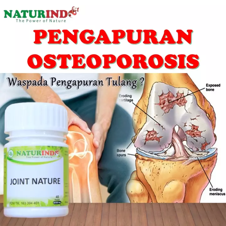 Detail Gambar Obat Osteoporosis Nomer 52