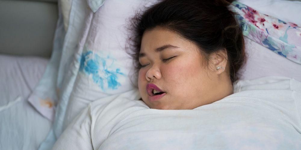 Detail Gambar Obesitas Tidur Nomer 2