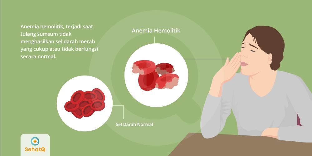 Detail Gambar Orang Anemia Nomer 47