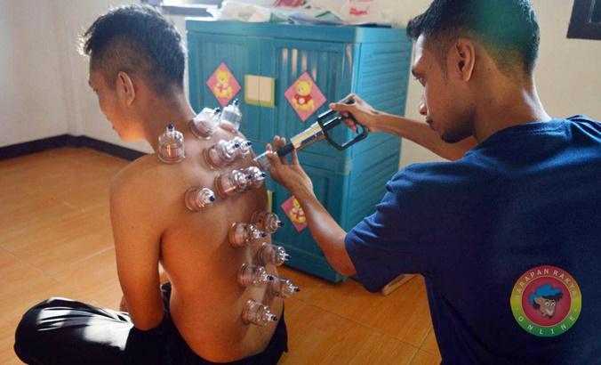 Detail Gambar Orang Bekam Nomer 28