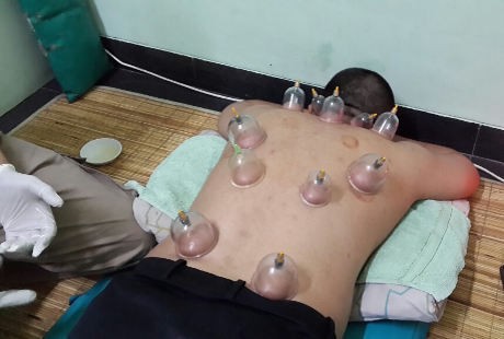 Detail Gambar Orang Bekam Nomer 30
