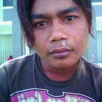Detail Gambar Orang Ingusan Nomer 36