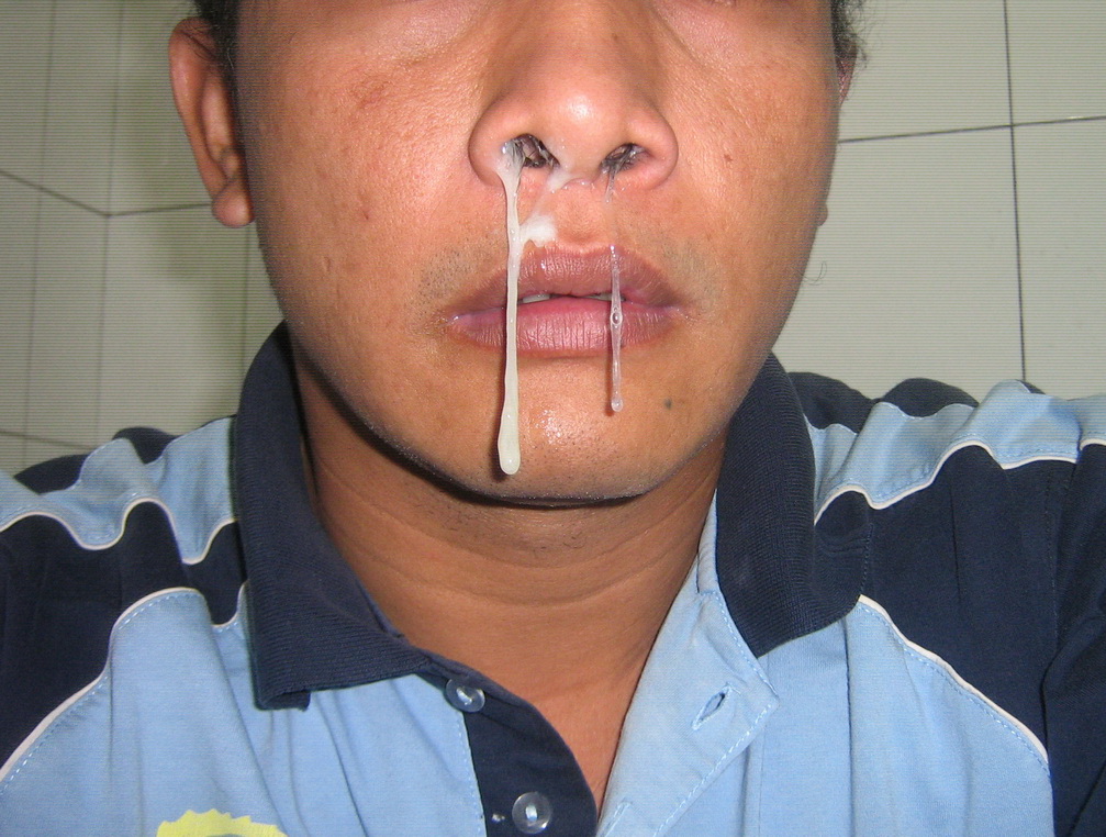 Detail Gambar Orang Ingusan Nomer 5
