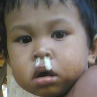 Detail Gambar Orang Ingusan Nomer 9