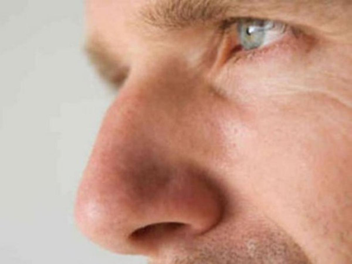 Detail Gambar Orang Menutup Idung Nomer 50