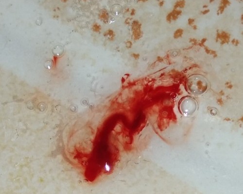 Detail Gambar Orang Muntah Darah Nomer 3