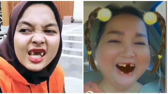 Detail Gambar Orang Ompong Nomer 2