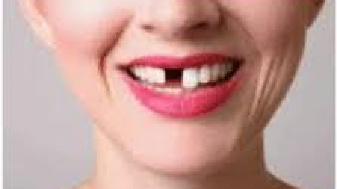 Detail Gambar Orang Ompong Nomer 17