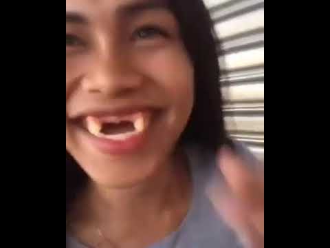 Detail Gambar Orang Ompong Nomer 6