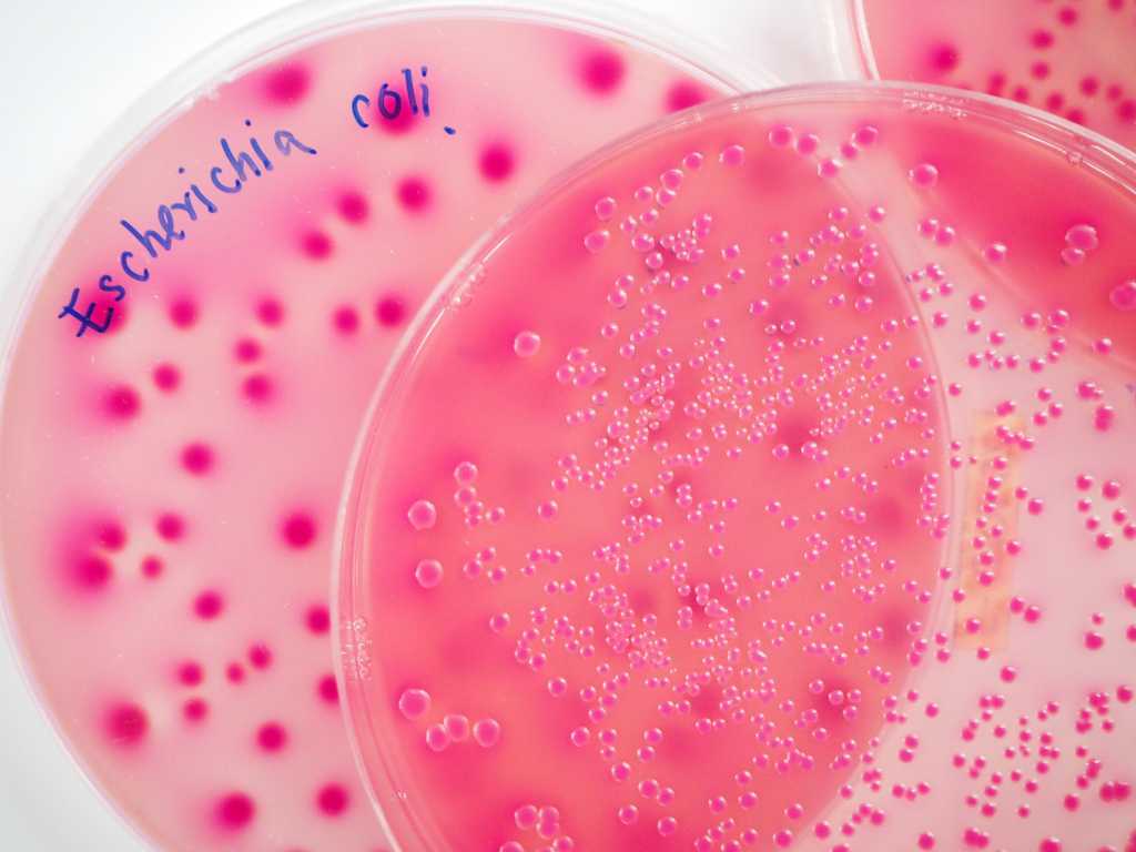 Detail Gambar Orang Sakit Bakteri E Colli Nomer 27