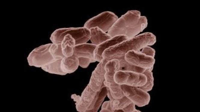 Detail Gambar Orang Sakit Bakteri E Colli Nomer 47