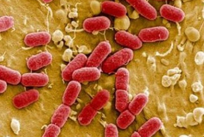 Detail Gambar Orang Sakit Bakteri E Colli Nomer 9