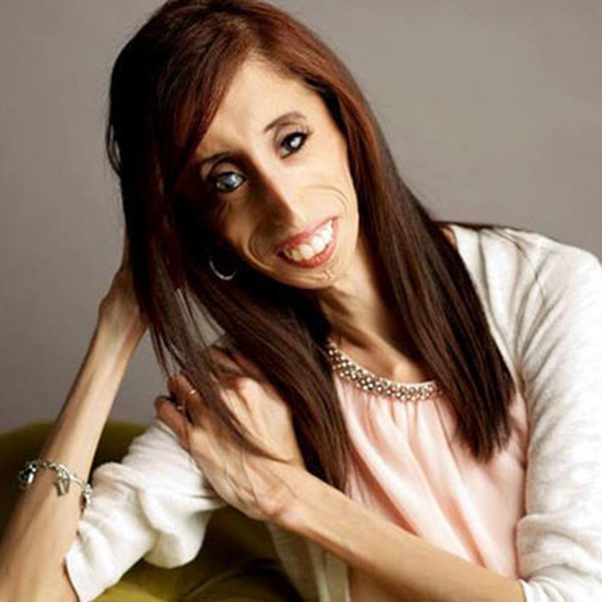Lizzie Velasquez Pics