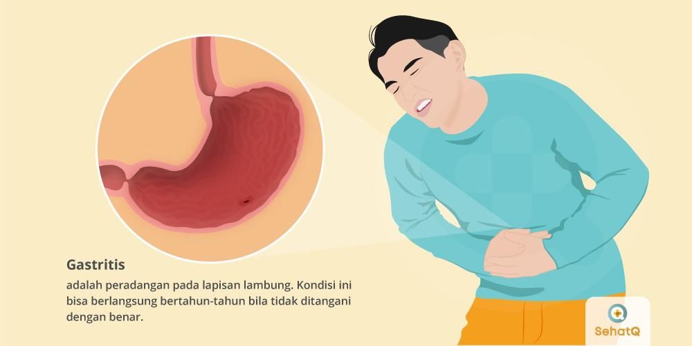 Detail Gambar Orang Terkena Gastritis Nomer 2